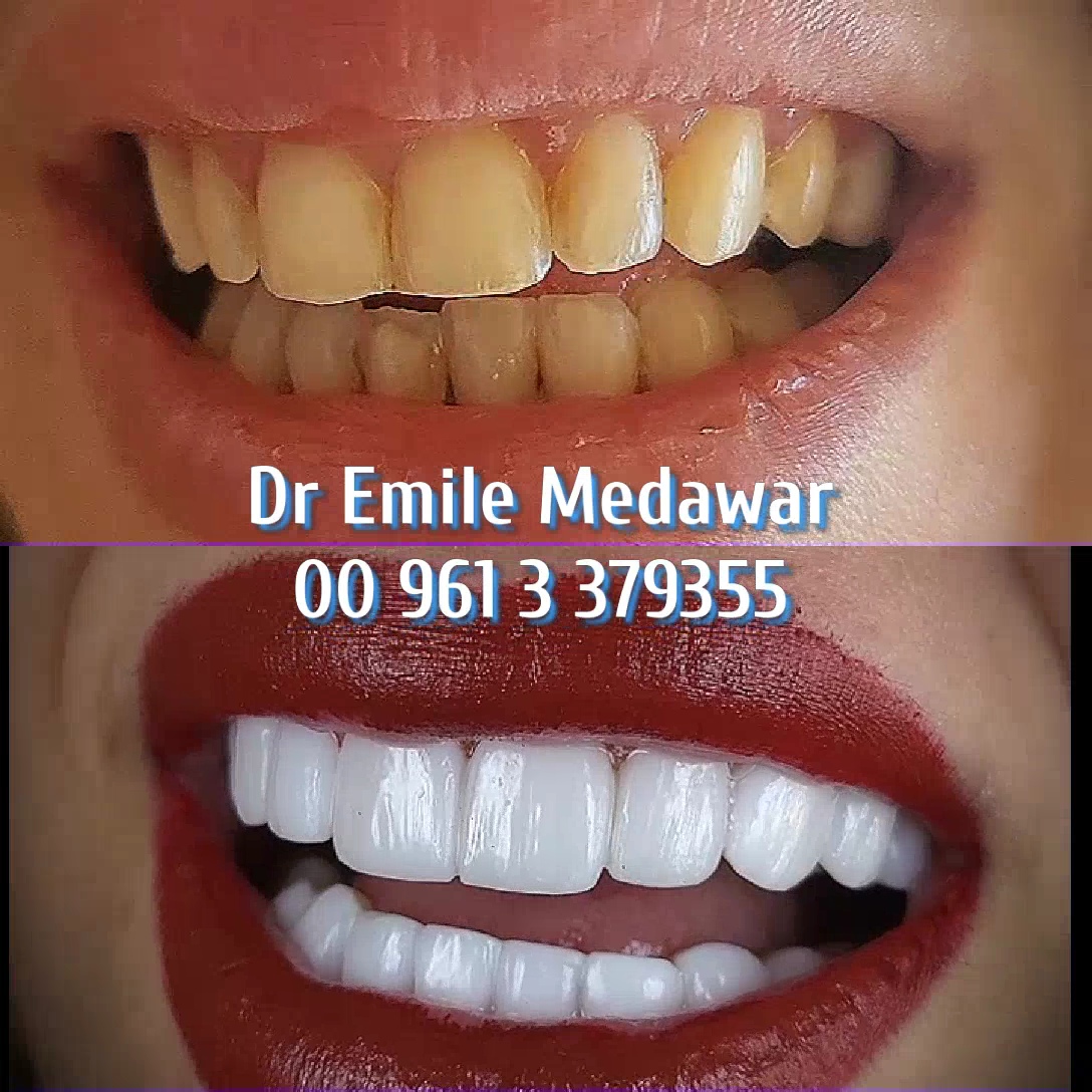 Best Dental clinic Lebanon